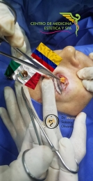 Rejuvenecimiento - Cirugía estética y Bariatría en Puebla - Dr. Mario Salazar Olivares - Puebla