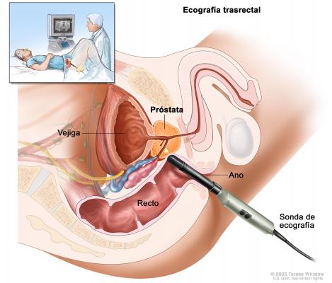 Medico urologo que es