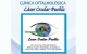 Láser Ocular Puebla