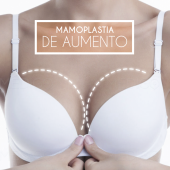 Mamoplastia de aumento en Puebla - Dr. Gerardo Rayón Nieva- Cirujano Plástico