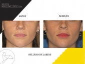  - Beleco - Medicina Estética