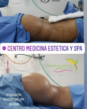  - Cirugía estética y Bariatría en Puebla - Dr. Mario Salazar Olivares