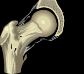 Especialista en cirugía de cadera y rodilla. - Ortopedista - Dr. Cristian Rivera Reyes