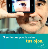  - GLAUCOMA LASER