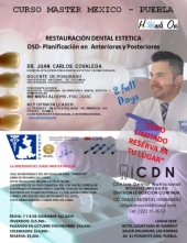 Restauración Dental Estética - Curso Master