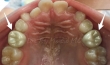 smilecare
