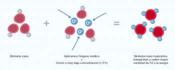 La terapia médica con ozono - Bariatra en Puebla - Dr. Alejandro Domínguez Díaz - Medicina Biológica...