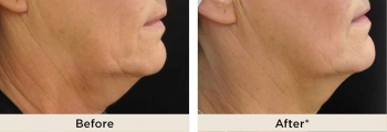 Profesionalismo y salud. - Beleco - Medicina Estética - Puebla