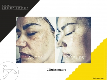 Beleco - Medicina Estética - Puebla