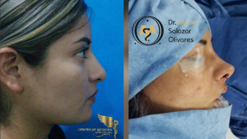 Cirugía estética y Bariatría en Puebla - Dr. Mario Salazar Olivares - Puebla
