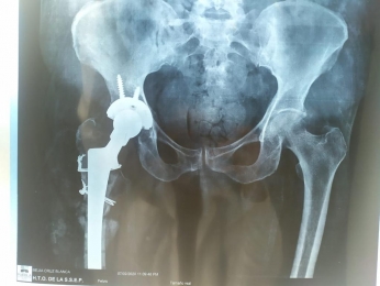 Ortopedista - Dr. Cristian Rivera Reyes - Puebla