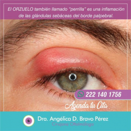 Dra. Angélica D. Bravo Pérez - Cirujana Oftalmóloga - Puebla