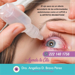 Dra. Angélica D. Bravo Pérez - Cirujana Oftalmóloga - Puebla