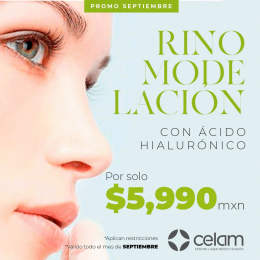 Rino modelación, con ácido hilaluronico  - CELAM - Centro Médico Láser de Sonata - Puebla
